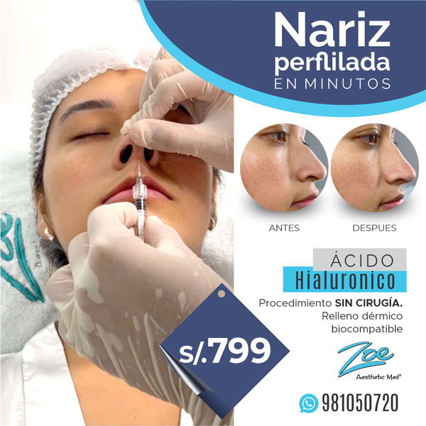 acido-hialuronico-rinoplastia-precio